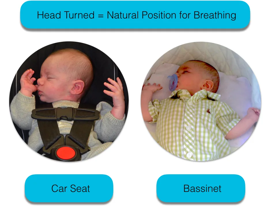 positional asphyxiation